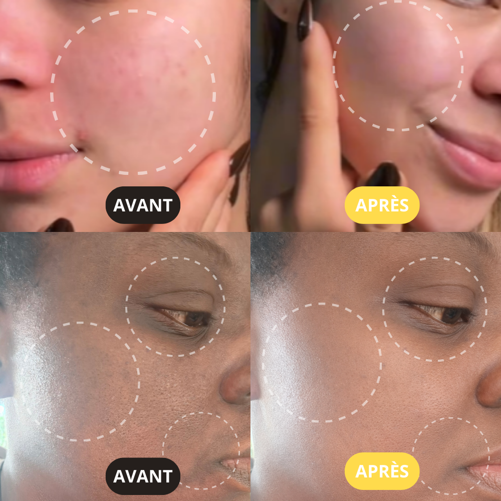 NOYHA - Masque effervescent au curcuma anti-taches