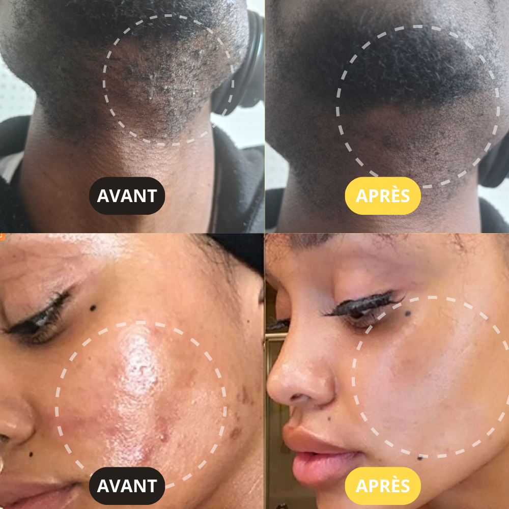 NOYHA - Masque effervescent au curcuma anti-taches